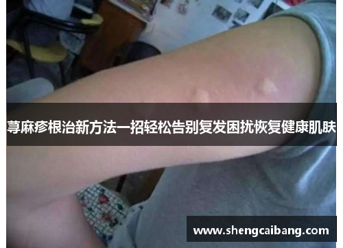 荨麻疹根治新方法一招轻松告别复发困扰恢复健康肌肤