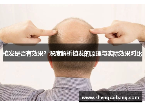 植发是否有效果？深度解析植发的原理与实际效果对比